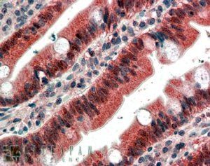 FGFR1 Antibody