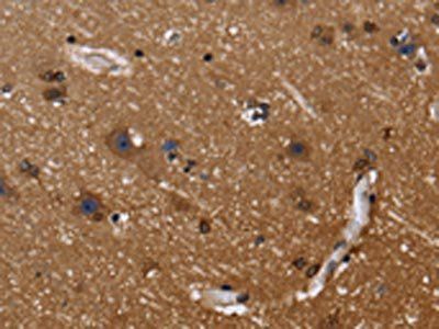 FGFR1OP Antibody