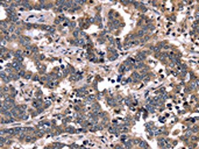 FGFR1OP2 Antibody