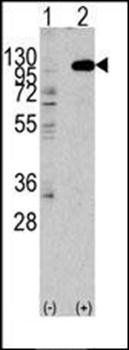 FGFR2 antibody