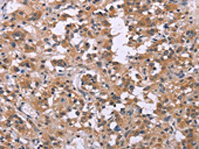 FGFR2 Antibody