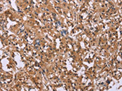 FGFR2 Antibody