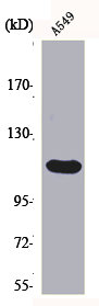 FGFR2 Antibody
