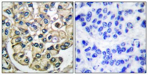 FGFR2 Antibody