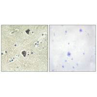 FGFR3 Antibody