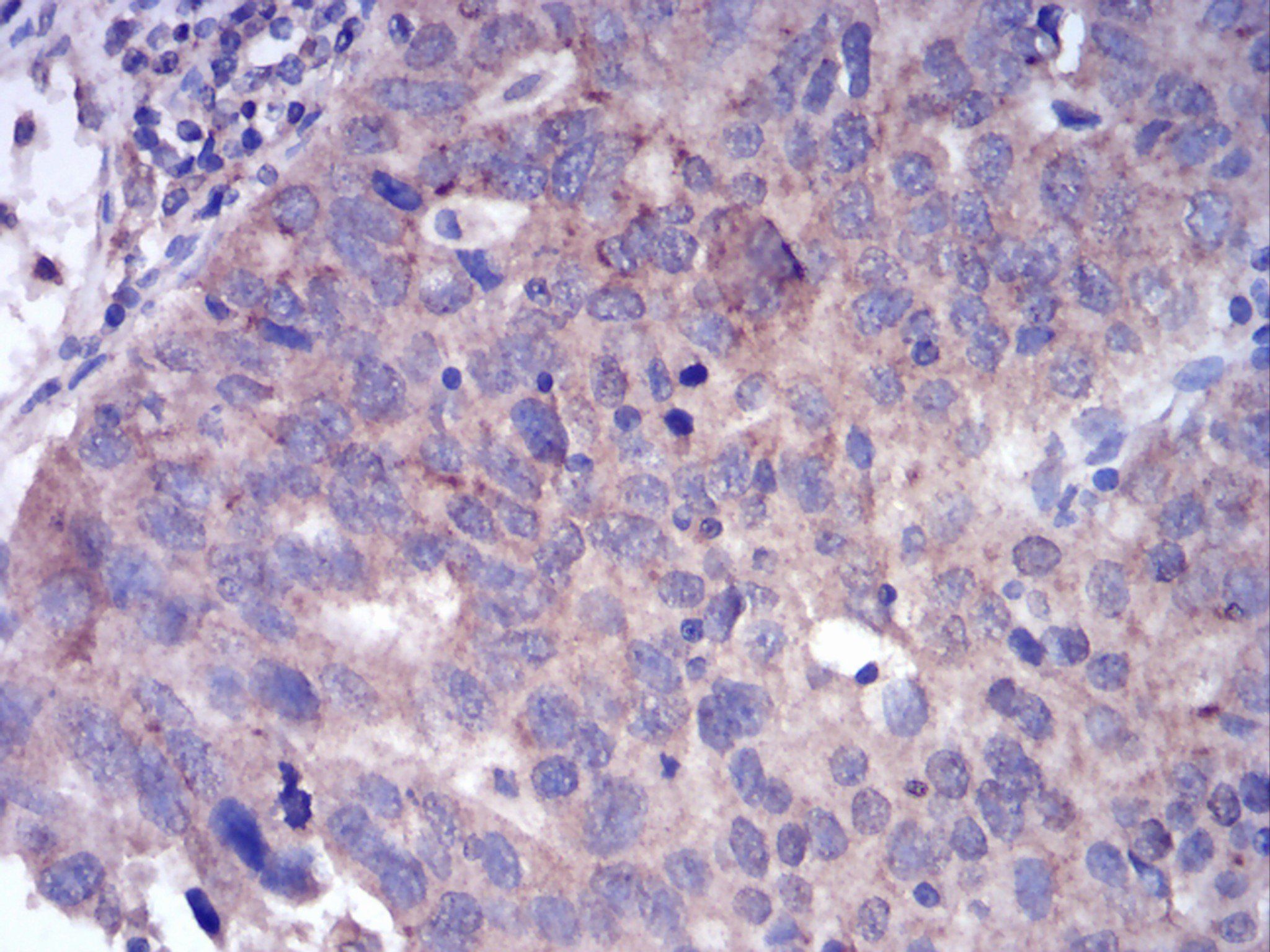 FGFR3 Antibody