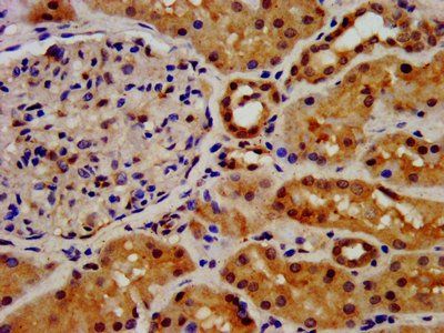 FGFRL1 Antibody