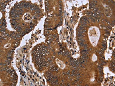 FGFRL1 Antibody