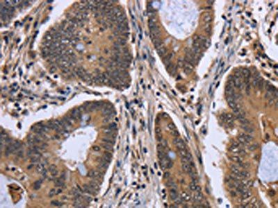 FGFRL1 Antibody