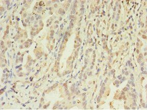 FGL2 Antibody