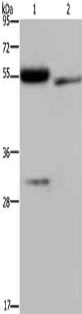 FGL2 Antibody