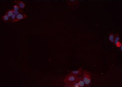 AKT (Phospho-Ser473) antibody