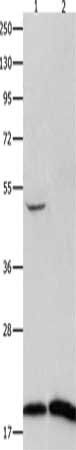 FHIT Antibody