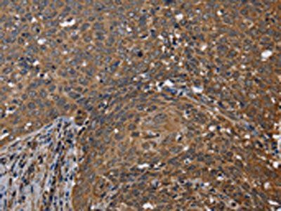 FHIT Antibody