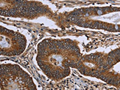 FHIT Antibody