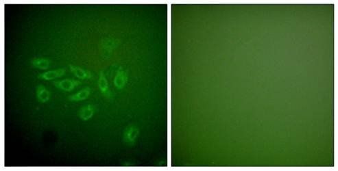 FHIT Antibody