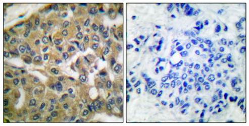 FHIT Antibody