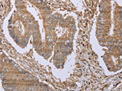 FHL1 Antibody
