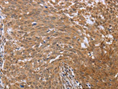 FHL2 Antibody