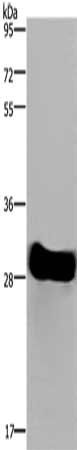 FHL2 Antibody