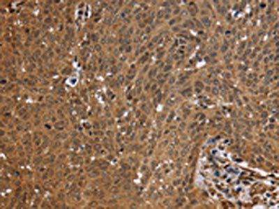 FHL2 Antibody