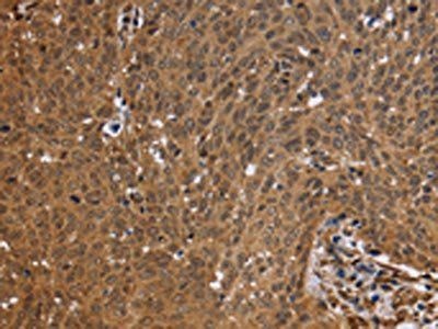 FHL2 antibody