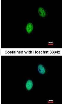 FHL5 antibody