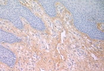 Human Fibronectin Antibody