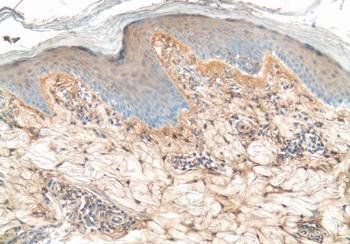 Fibronectin, bovine Antibody