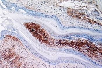 Chicken Fibronectin Antibody