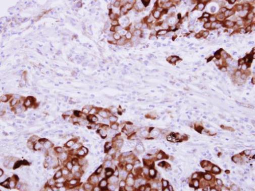 Fibrinogen gamma antibody