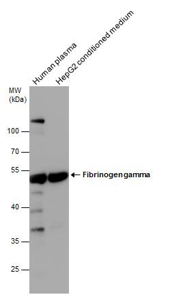 Fibrinogen gamma antibody