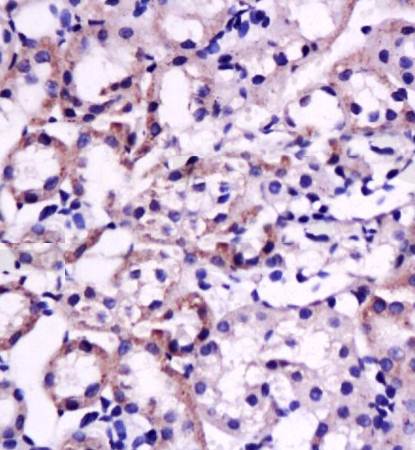 FGL2 Rabbit Polyclonal Antibody