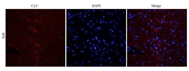 Fibrinopeptide B antibody