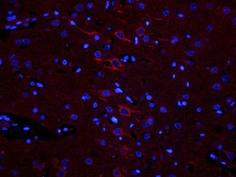 Fibrinopeptide B antibody