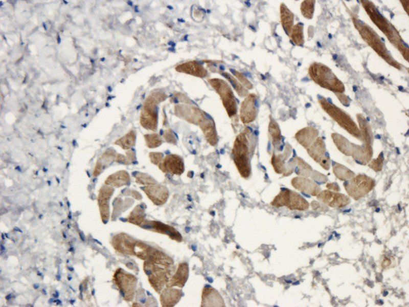 Fibrinopeptide B antibody