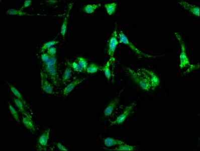 Fibroblast growth factor R 3 antibody