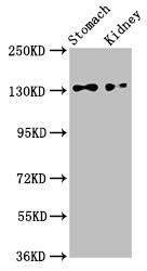 FILIP1L antibody