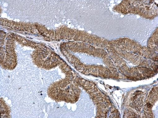 fission, mitochondrial 1 Antibody