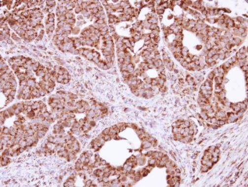 fission, mitochondrial 1 Antibody