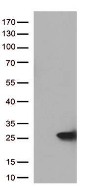 SH3PXD2A Antibody