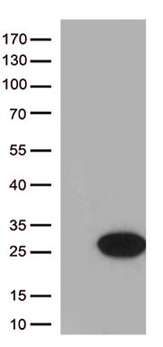 SH3PXD2A Antibody