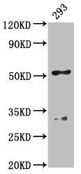 FIZ1 antibody