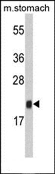 FKBP11 antibody