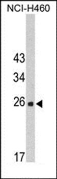 FKBP14 antibody
