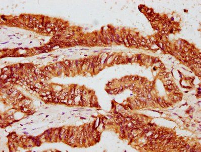 FKBP4 Antibody