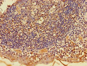 FKBP8 Antibody