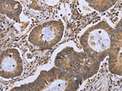FKBP8 Antibody