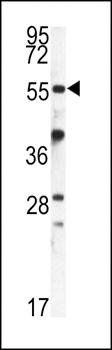 FKBP9 antibody