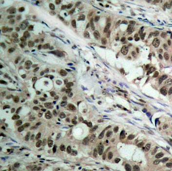 FKHR (Ab-256) Antibody